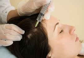 Мезотерапия - инъекции под кожу головы