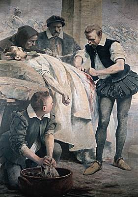 француз избавивший раненых солдат от обычая прижигать рану раскаленным железом