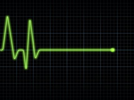 кардиограмма и сердечный ритм