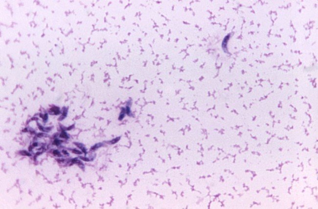 Токсоплазмоз болезнь под микроскопом