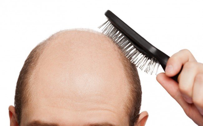 Как остановить выпадения волос?