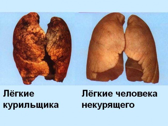 здоровье, лёгкие курящего, разрушение лёгких никотином, никотин и организм, влияние курения на организм, организм, вред курение