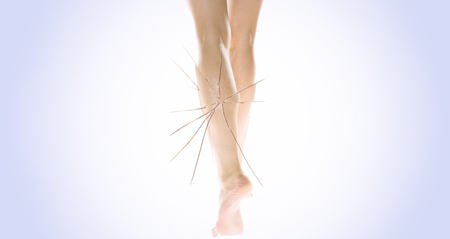 ноги женские лечение