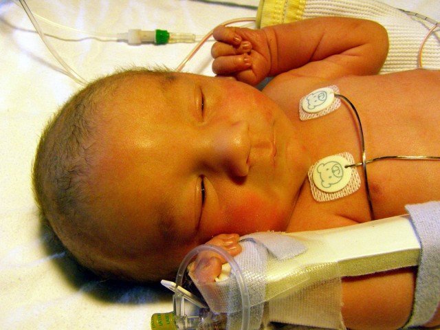 Желтуха у новорожденного - Окситоцин, что это такое