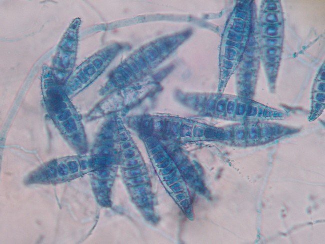 грибки Microsporum под микроскопом