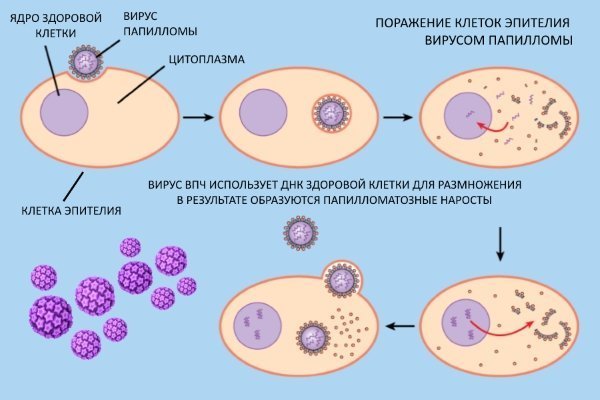 репликация вируса папилломы