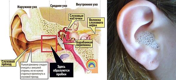 ᐈ Откуда берется ушная пробка и что делать если много серы в ушах?