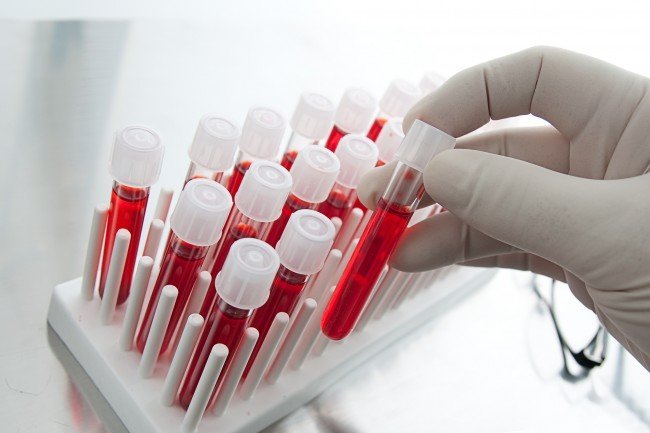 Антибиотики оказывают влияние на анализ крови?