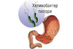 Бактерия, которая служит причиной гастрита.