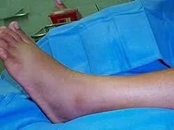 Болит нога: к какому врачу идти