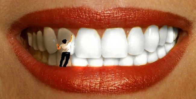 отбеливание зубов