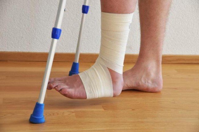 Почему болит нога в лодыжке через год после снятия гипса