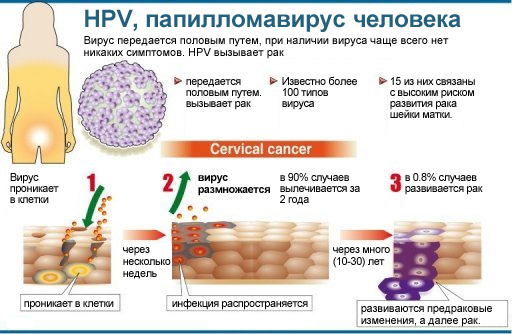 папилломавирус человека
