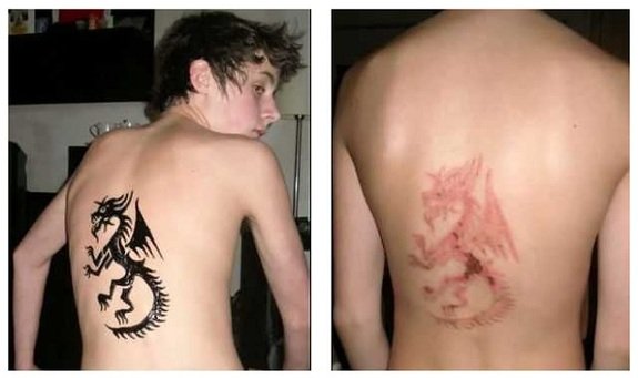 последствия после татуировок