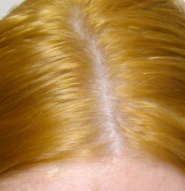 желтизна волос