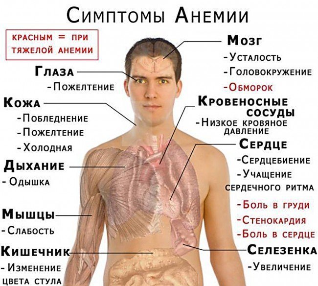 симптомы анемии