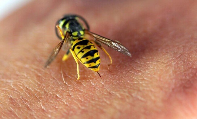 укус пчелы, что делать