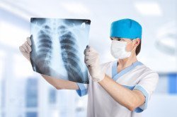 Затемнение в легких: рентген